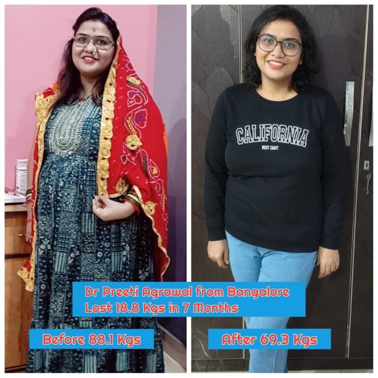 Member transformation