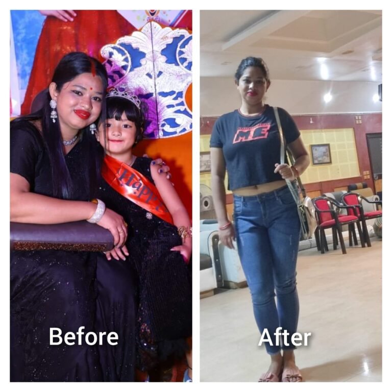 Member transformation