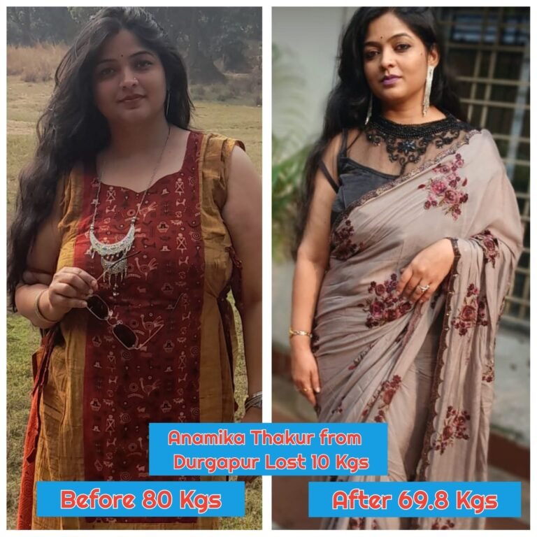 Member transformation