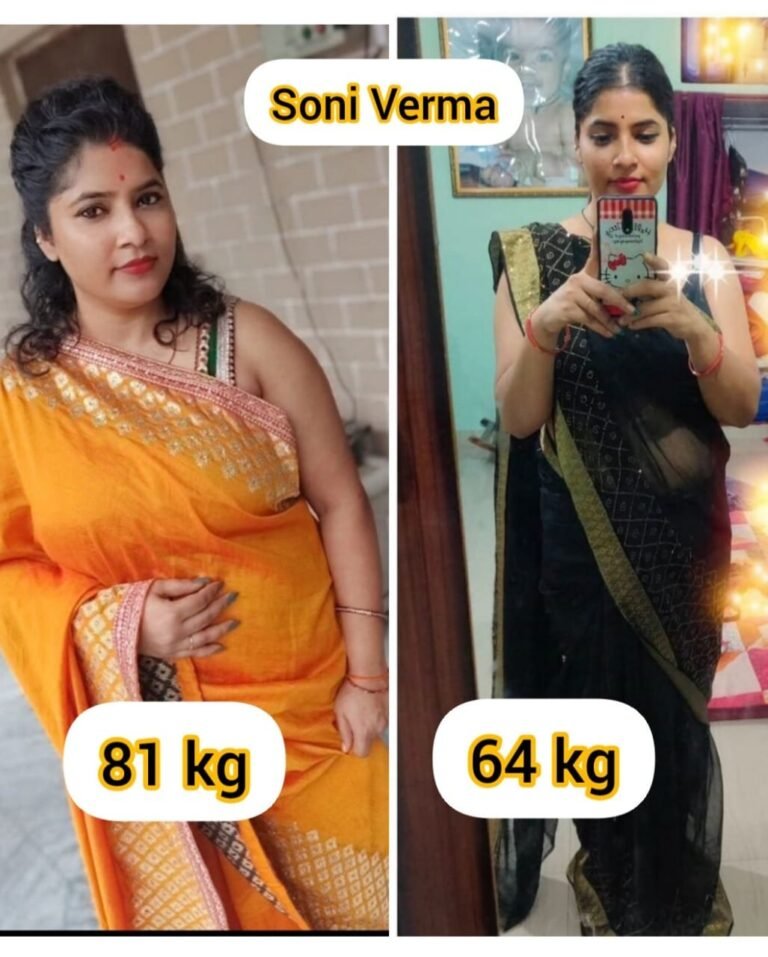 Member transformation